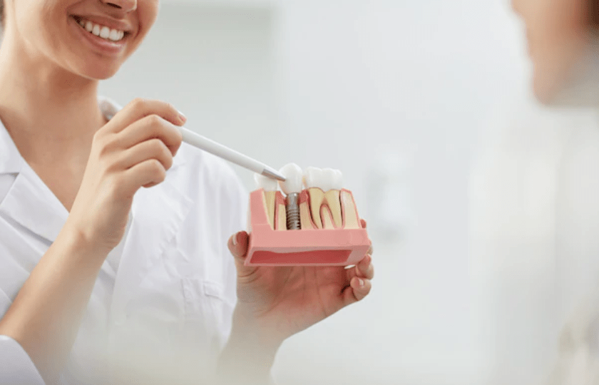 Dental Implants in Balwyn’s Oral Care Scene: An Insight Dental Implants in Balwyn’s Oral Care Scene: An Insight