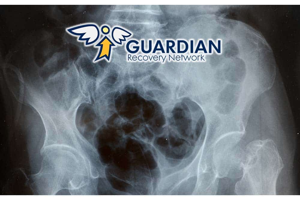 Effects Of Smoking And Alcohol On Bone Density Effects Of Smoking And Alcohol On Bone Density