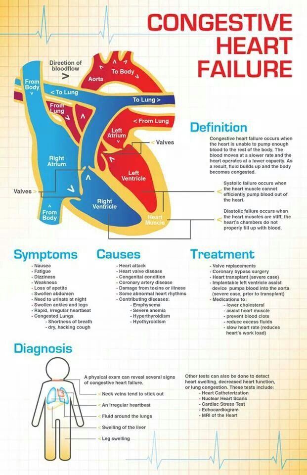 Heart Failure: Causes, Symptoms, And Treatment Heart Failure: Causes, Symptoms, And Treatment