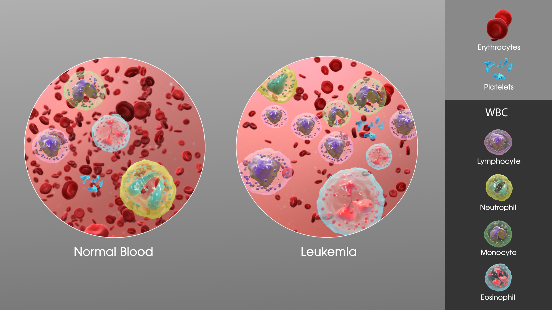 Understanding Leukemia: Types, Symptoms, And What You Need To Know Understanding Leukemia: Types, Symptoms, And What You Need To Know