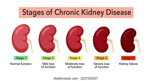 Bone Health And Chronic Kidney Disease Bone Health And Chronic Kidney Disease
