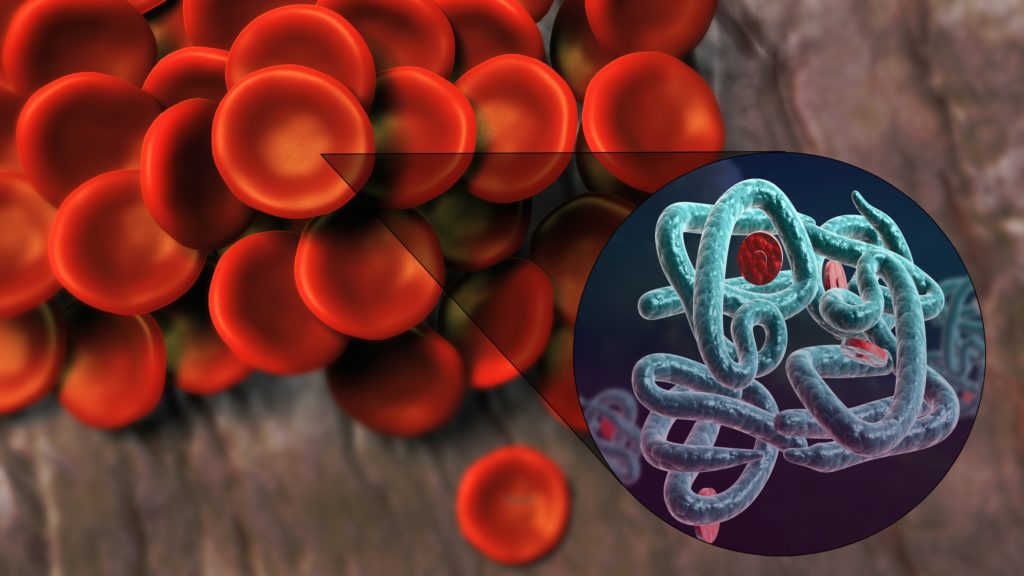 Medical Advances In Treating Rare Chronic Conditions – Part 10 Medical Advances In Treating Rare Chronic Conditions – Part 10