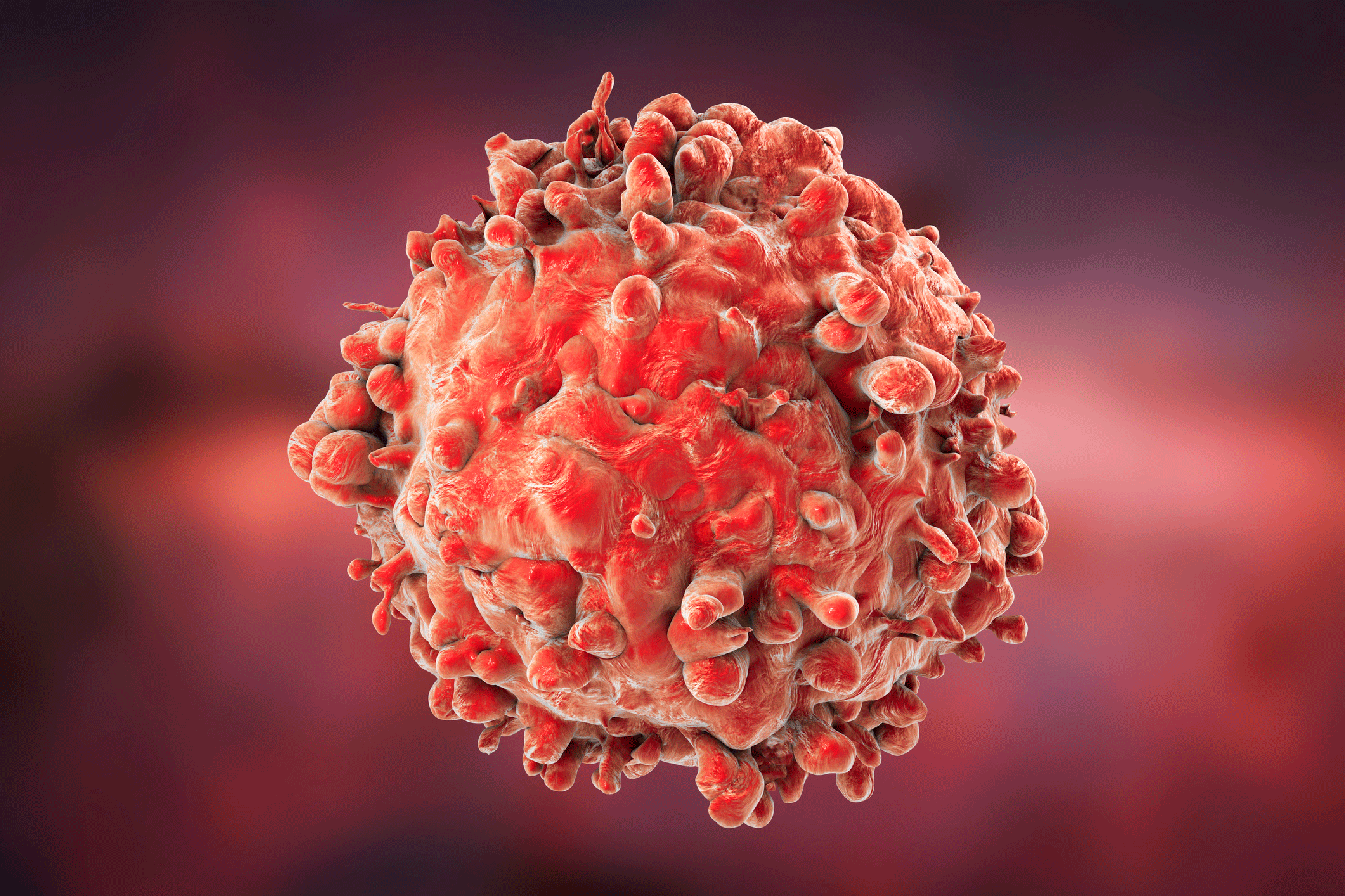 Leukemia And Neurocognitive Function: Insights From Research Leukemia And Neurocognitive Function: Insights From Research