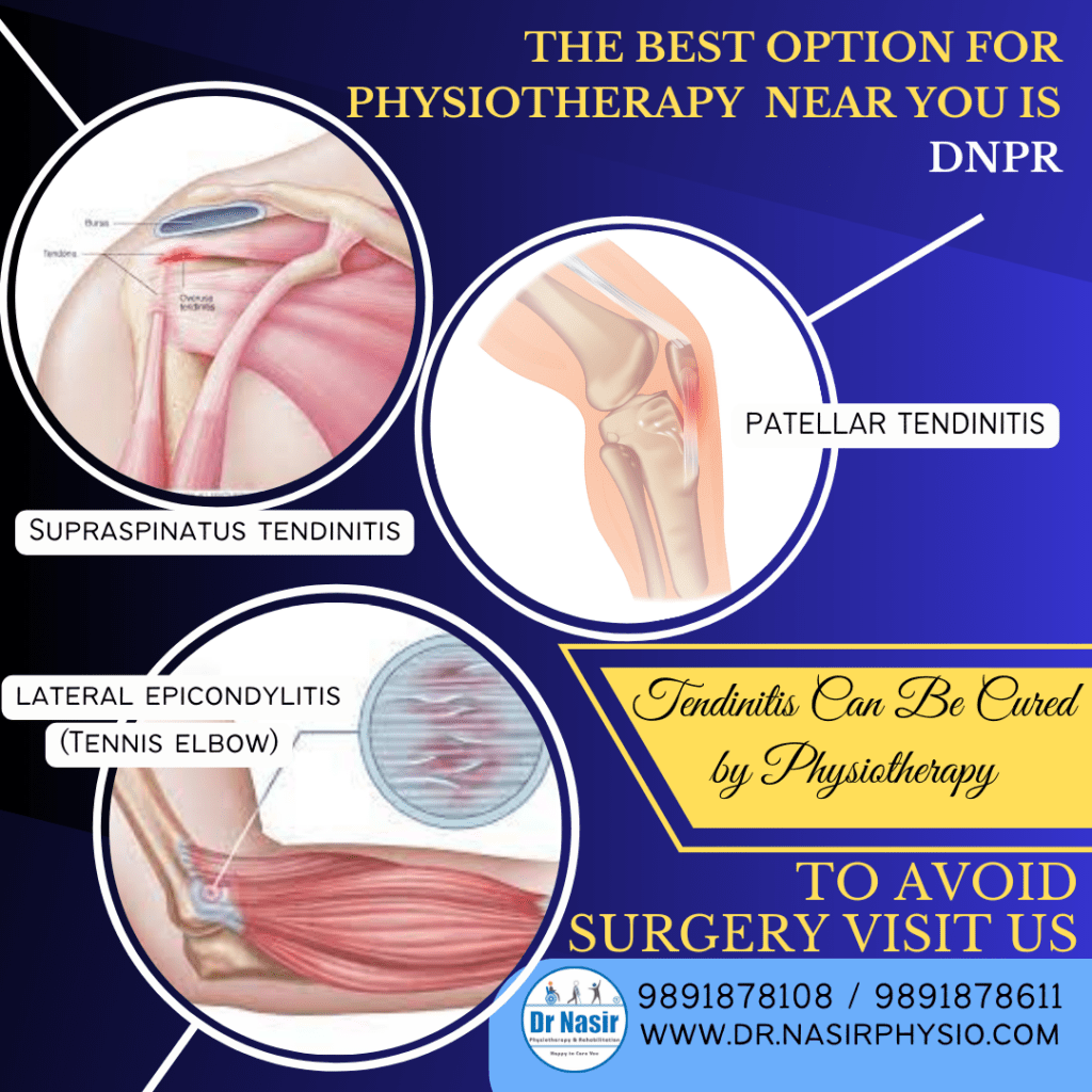 Tendinitis: Symptoms, Causes, And Treatment Tendinitis: Symptoms, Causes, And Treatment