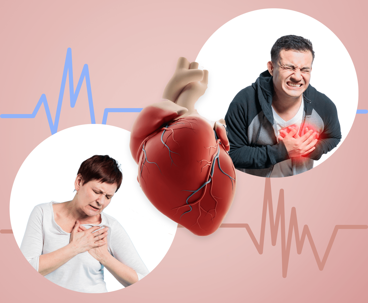 Heart Disease In Patients With Autoimmune Disorders Heart Disease In Patients With Autoimmune Disorders
