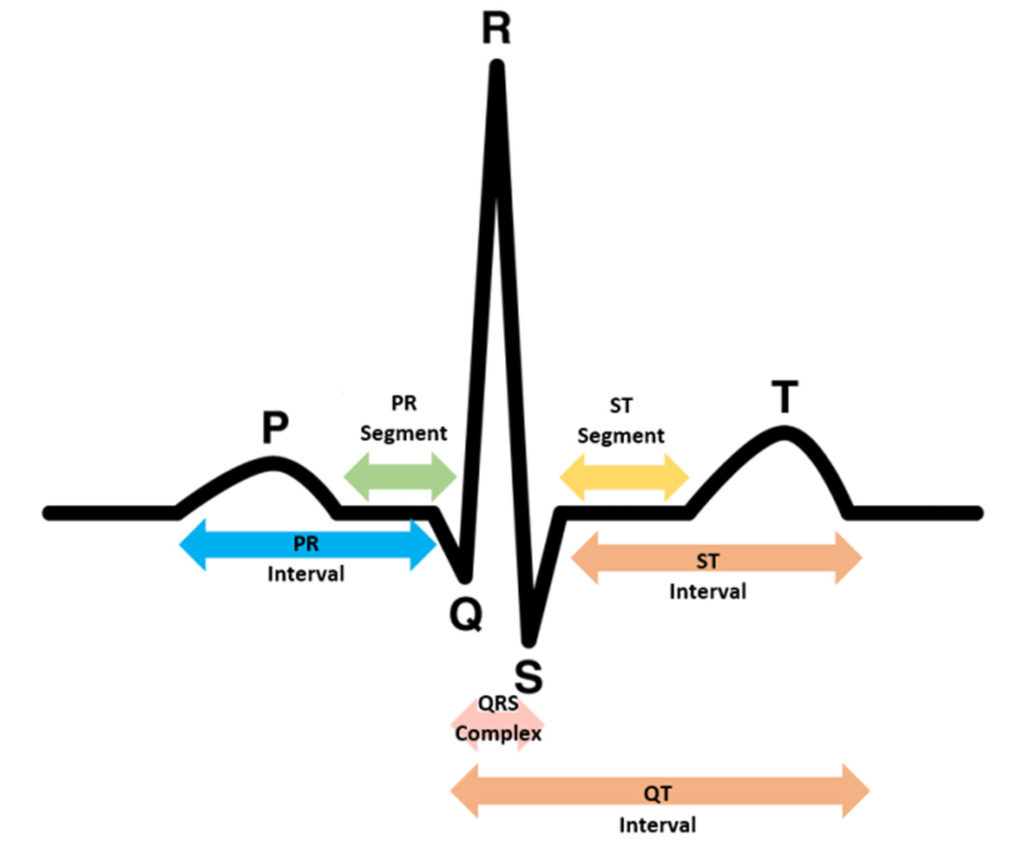 Left Ventricular Hypertrophy Explained Left Ventricular Hypertrophy Explained