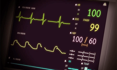 Electrophysiology Studies And Heart Rhythm Electrophysiology Studies And Heart Rhythm