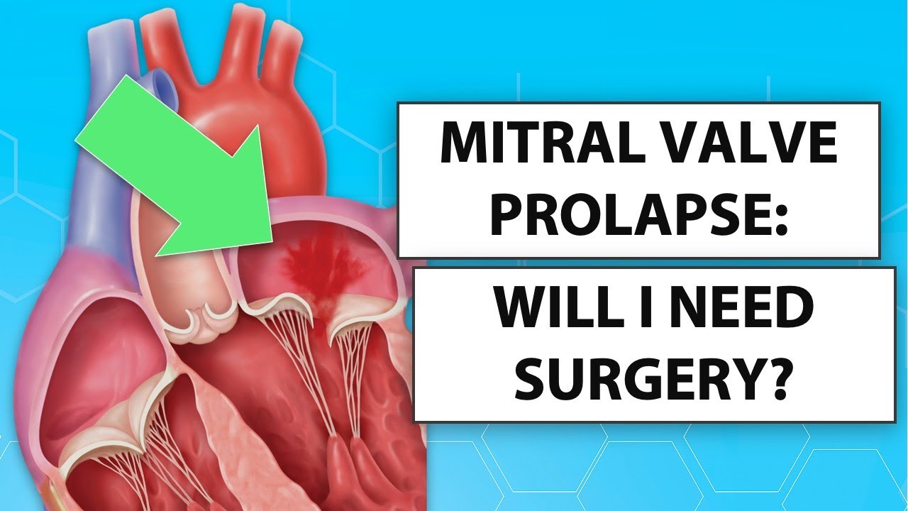 Mitral Valve Prolapse: Symptoms And Care Mitral Valve Prolapse: Symptoms And Care