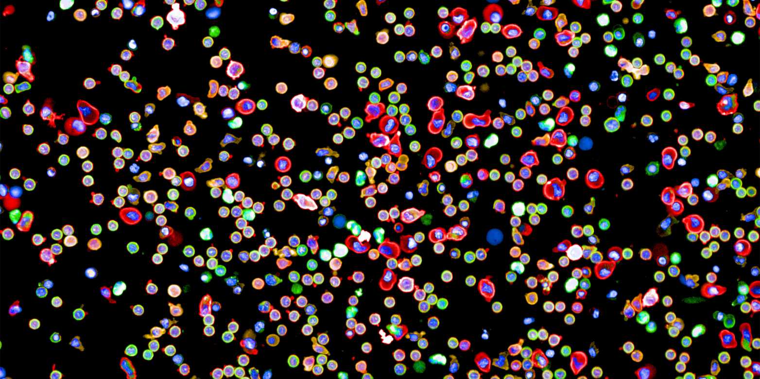 Bone Health And The Immune System: Connections And Implications Bone Health And The Immune System: Connections And Implications