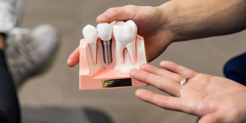 Bone Grafting: Procedures And Applications Bone Grafting: Procedures And Applications