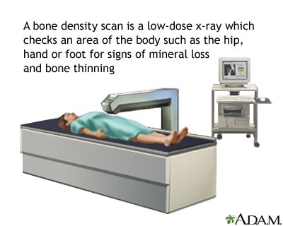 Bone Density Tests: Importance And Types Bone Density Tests: Importance And Types