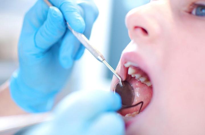 Tooth Decay Causes Should Avoid Tooth Decay Causes Should Avoid