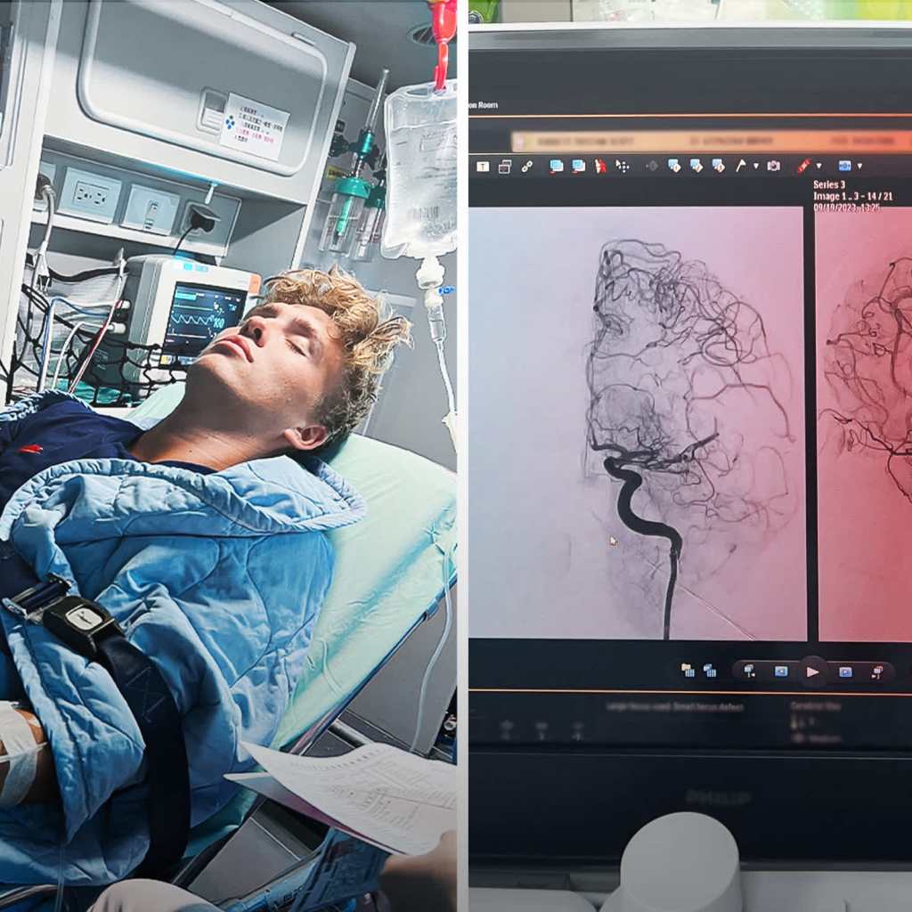 A stroke turned his World Cup right into a nightmare. A medical ‘miracle’ saved his life A stroke turned his World Cup right into a nightmare. A medical ‘miracle’ saved his life