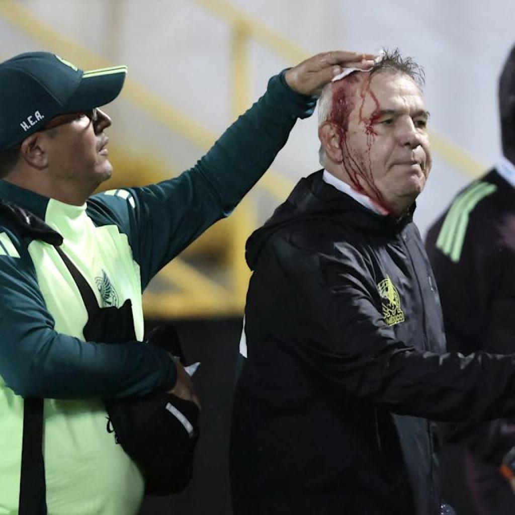 Mexico supervisor Javier Aguirre bloodied after being hit with beer can following loss to Honduras Mexico supervisor Javier Aguirre bloodied after being hit with beer can following loss to Honduras