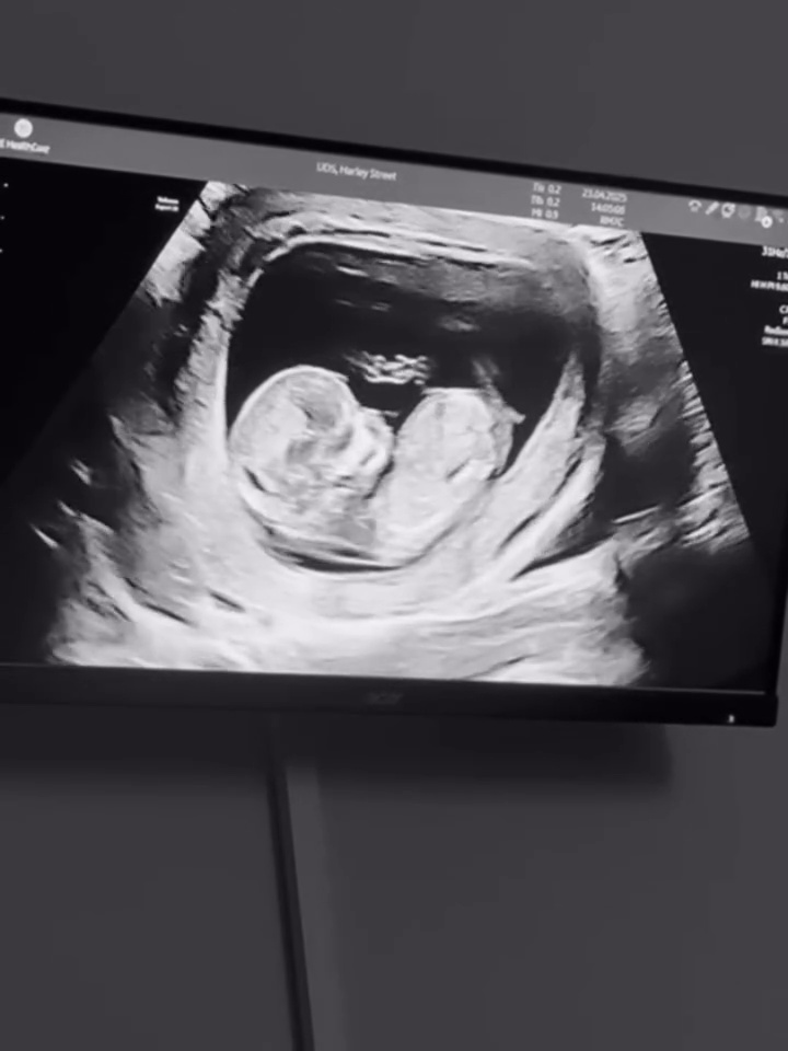 David Brooks to become a dad for first time just four years after beating cancer David Brooks to become a dad for first time just four years after beating cancer