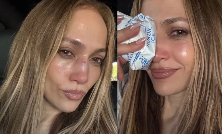 Jennifer López suffers from speaking fall during trials of the American Music Awards 2025 Jennifer López suffers from speaking fall during trials of the American Music Awards 2025