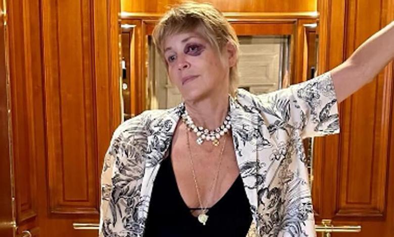 Sharon Stone brought peace of mind to her followers and revealed the mystery of her black eye: “I got disoriented” Sharon Stone brought peace of mind to her followers and revealed the mystery of her black eye: “I got disoriented”