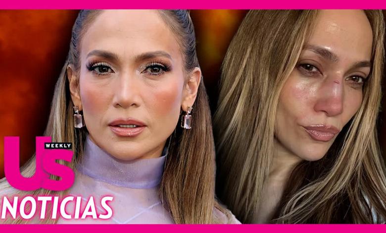 Jennifer Lopez shares photos of a severe facial injury during the tests of the Amas Jennifer Lopez shares photos of a severe facial injury during the tests of the Amas
