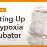 怎麼知道自己缺氧? 怎麼知道自己缺氧?