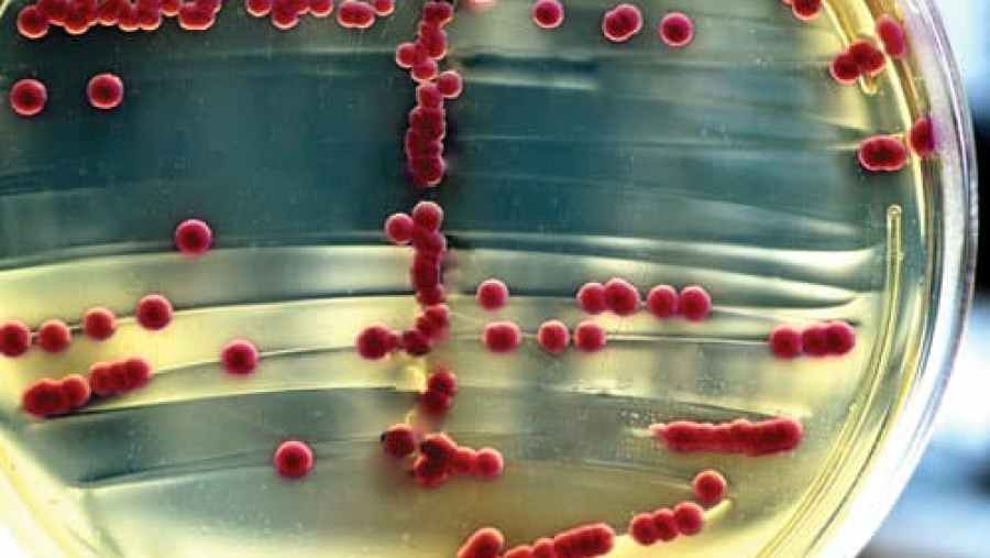 North America Protein Expression Systems Market In Focus: Size, Share, and Growth Trends Explored through 2037 North America Protein Expression Systems Market In Focus: Size, Share, and Growth Trends Explored through 2037