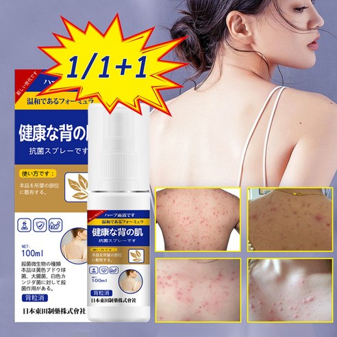 KORE LAN 1/1+1 바디여드름/등드름개선/가려움증을 빠르게 완화 /진드기 제거 /보디 스프레이, 1개, 100ml