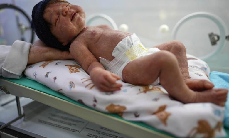 Brazil’s lifelike doll craze is popular as online videos spark political reactions Brazil’s lifelike doll craze is popular as online videos spark political reactions