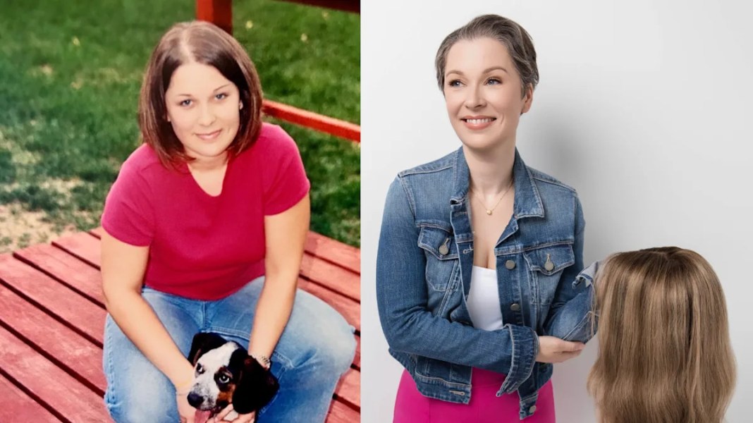 How Hair Loss Affected My Self-Esteem: Essential Insights for Women Navigating Dating