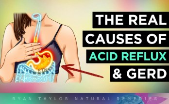 reflux reflux