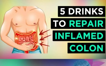 5 Best Drinks to Soothe and Heal Colon Inflammation 5 Best Drinks to Soothe and Heal Colon Inflammation