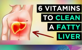 6 Powerful Vitamins That Transform Your Fatty Liver Naturally 6 Powerful Vitamins That Transform Your Fatty Liver Naturally