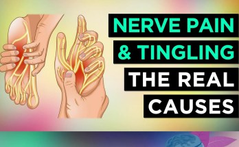 7 Common Causes of Nerve Pain and Tingling in Extremities: A Comprehensive Guide 7 Common Causes of Nerve Pain and Tingling in Extremities: A Comprehensive Guide