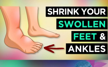 Effective Home Remedies for Reducing Swollen Feet and Ankles: A Comprehensive Guide Effective Home Remedies for Reducing Swollen Feet and Ankles: A Comprehensive Guide