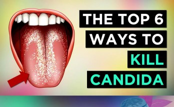 6 Proven Ways to Treat Candida Overgrowth and Yeast Infections Permanently 6 Proven Ways to Treat Candida Overgrowth and Yeast Infections Permanently