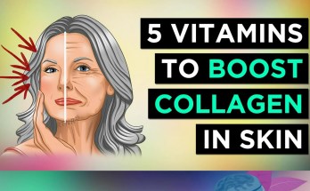 5 Essential Vitamins to Naturally Boost Collagen for Radiant Skin 5 Essential Vitamins to Naturally Boost Collagen for Radiant Skin