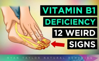 vitamin vitamin