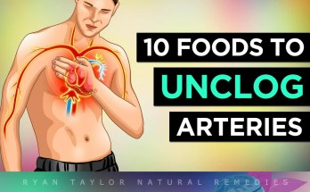 10 Heart-Healthy Foods to Support Clear Arteries and Cardiovascular Health 10 Heart-Healthy Foods to Support Clear Arteries and Cardiovascular Health