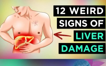 12 Unusual Symptoms That Could Indicate Liver Damage 12 Unusual Symptoms That Could Indicate Liver Damage