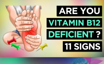 11 Warning Signs You Might Have a Vitamin B12 Deficiency 11 Warning Signs You Might Have a Vitamin B12 Deficiency