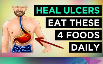 4 Best Foods to Naturally Heal Stomach Ulcers 4 Best Foods to Naturally Heal Stomach Ulcers