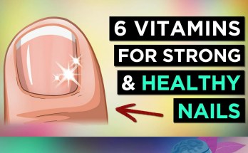 6 Essential Vitamins That Will Transform Your Brittle Nails 6 Essential Vitamins That Will Transform Your Brittle Nails
