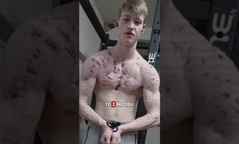 HATE For Showing Your Chest HATE For Showing Your Chest