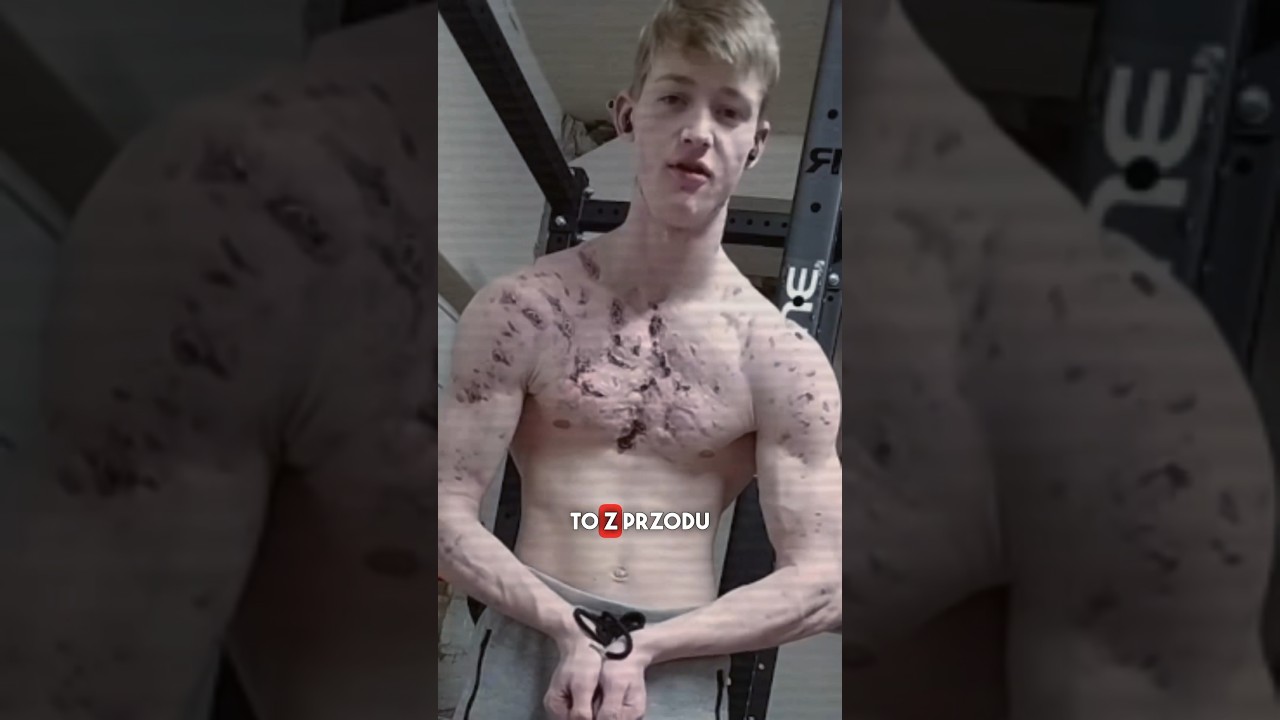 HATE For Showing Your Chest HATE For Showing Your Chest