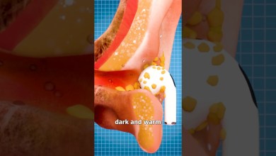 Why Your Earbuds Are GROSS 😨 Why Your Earbuds Are GROSS 😨