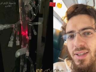 التفاصيل الكاملة لآخر خرجة للدكتور العزوزي مخترع جهاز تصفية الدم من داخل الاوعية الدموية بعد الهجوم الشرس عليه . التفاصيل الكاملة لآخر خرجة للدكتور العزوزي مخترع جهاز تصفية الدم من داخل الاوعية الدموية بعد الهجوم الشرس عليه .