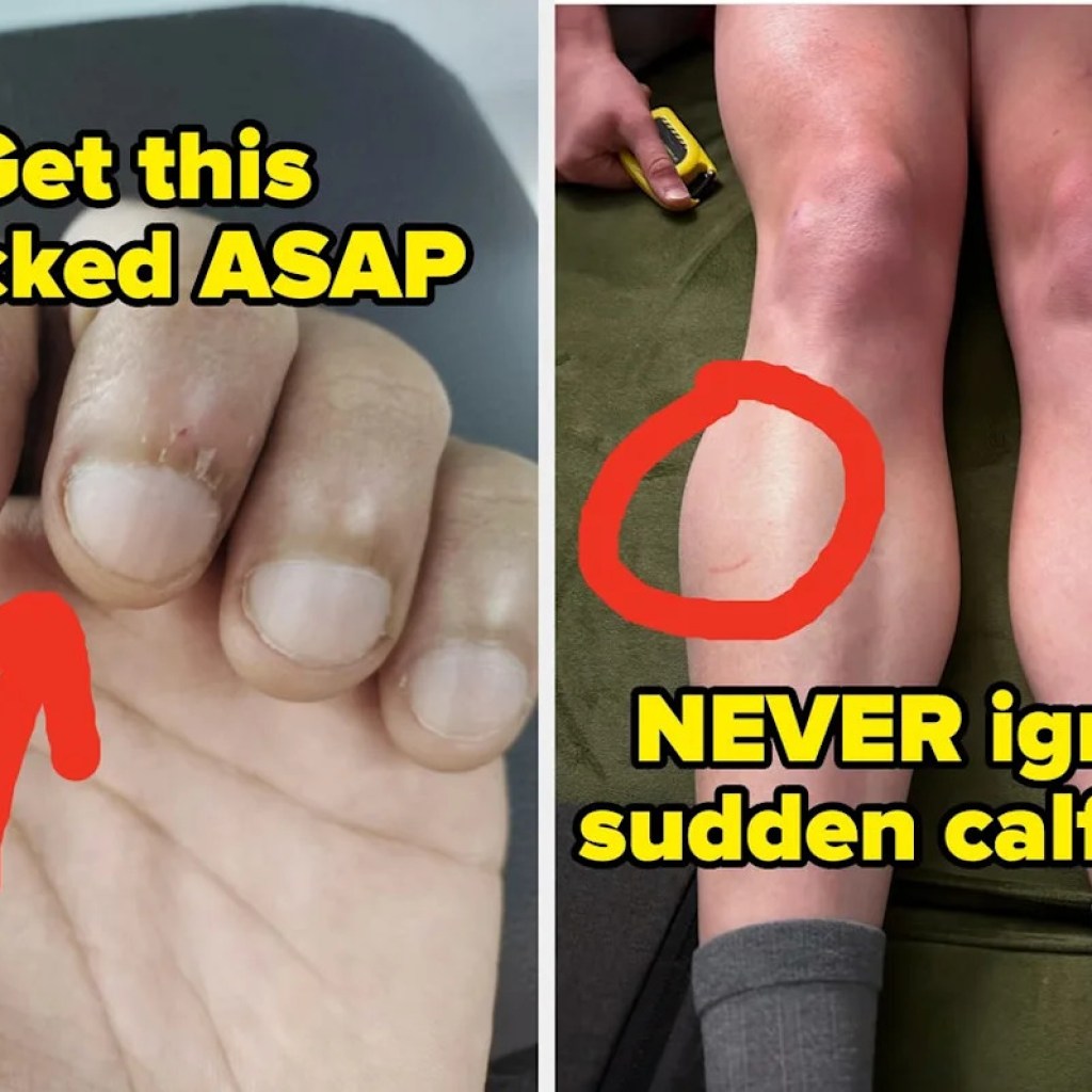 Los médicos y las enfermeras están revelando las „pequeñas“ señales de salud que nunca debe ignorar, y es impactante Los médicos y las enfermeras están revelando las „pequeñas“ señales de salud que nunca debe ignorar, y es impactante