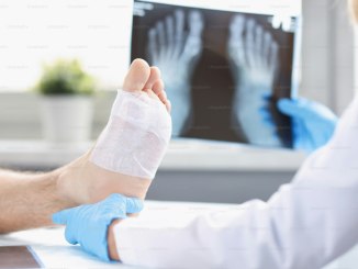 Bol u kostima i visok pritisak: Kada su povezani i šta treba znati? Bol u kostima i visok pritisak: Kada su povezani i šta treba znati?