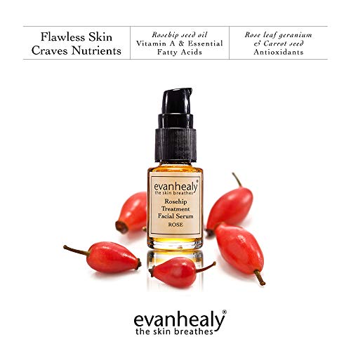 evanhealy Rosehip Facial Serum – Moisturizing & Plumping – All-Natural Hydrosols & Essential Oils – Damaged & Sensitive…