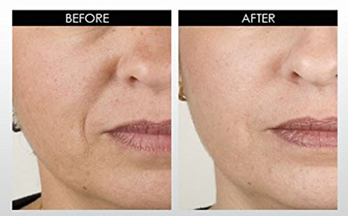 DNA Code-No Needle Alternative-Argireline NeuroPeptides Wrinkle Reduce Cream w/Matrixyl 3000, Syn-Ake, SNAP-8, Copper…