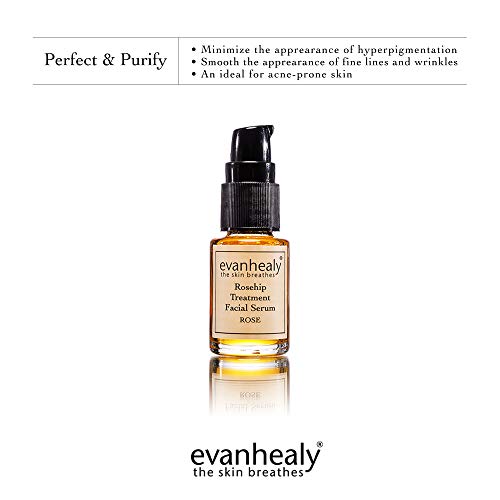 evanhealy Rosehip Facial Serum – Moisturizing & Plumping – All-Natural Hydrosols & Essential Oils – Damaged & Sensitive…
