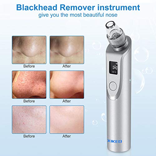 Blackhead Remover Vacuum-Pore Cleaner Vacuum Electric Suction Facial Comedo Acne Extractor Tool with LED Display for…